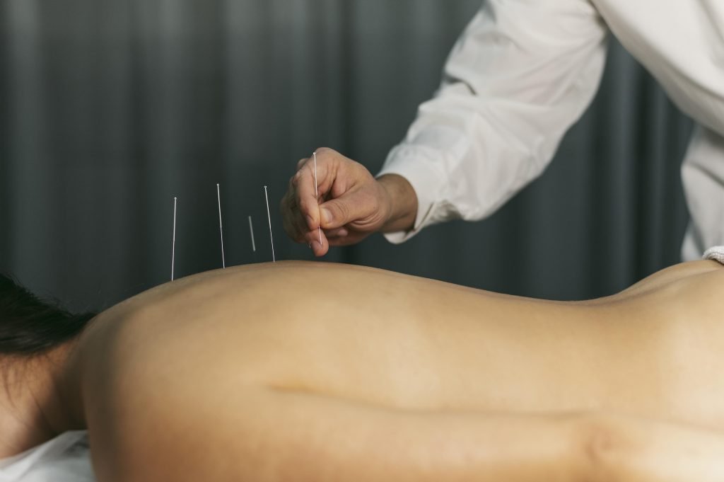 Acupuncturist in Roermond